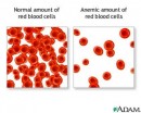 Diete per anemia